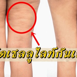 หุ่นเฟิร์มสร้างได้ไม่ยาก! กำจัดเซลลูไลท์ด้วย 4 วิธีง๊ายง่าย